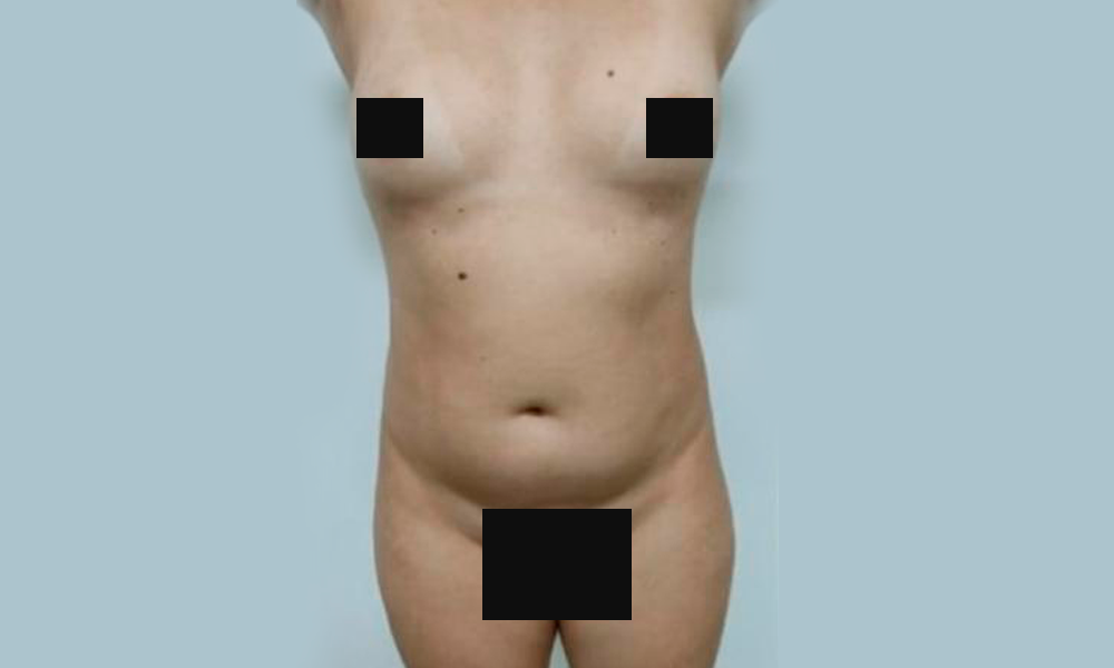 Antes x Depois Dr Sergio Rocha 12