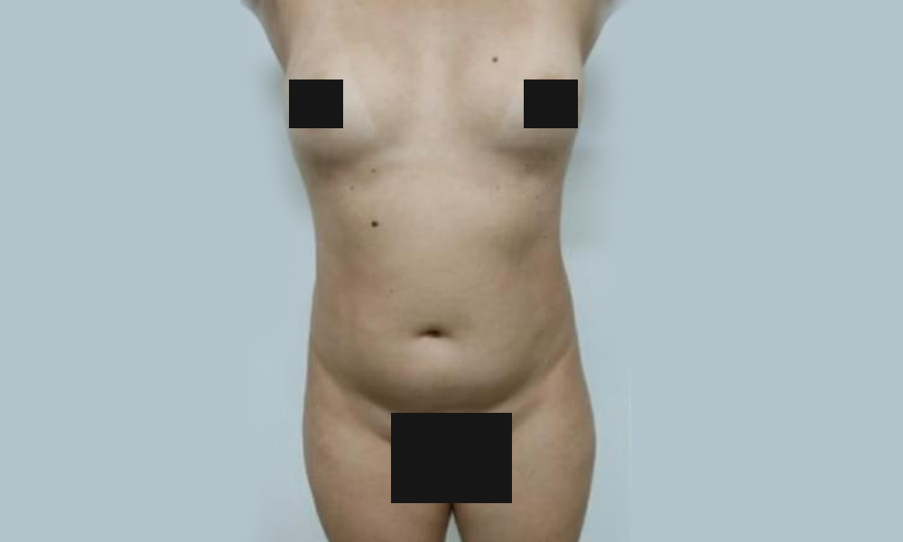 Antes x Depois Dr Sergio Rocha 12