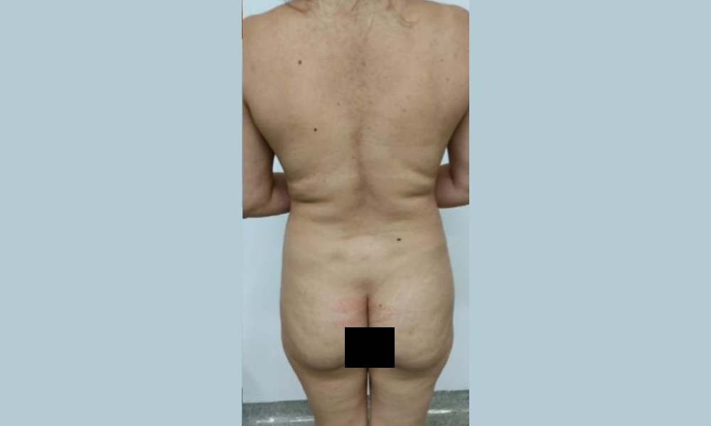 Antes Dr. Sergio 2 Antes Dr. Sergio 2